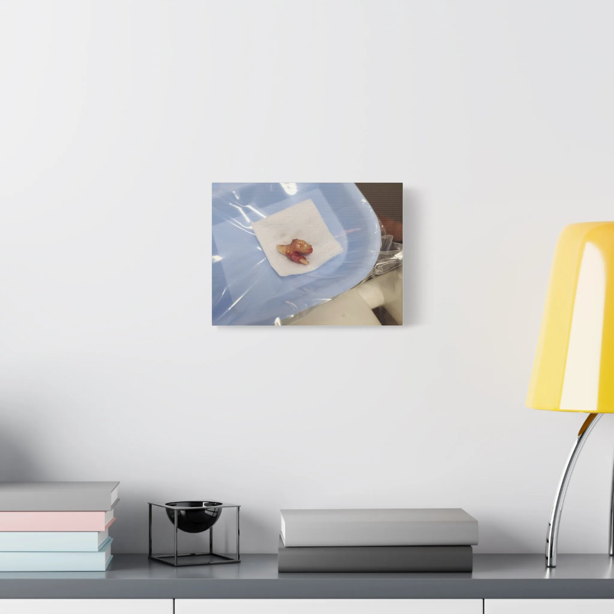 Unique Stretched Matte Canvas Art - Dental Curiosities Decor